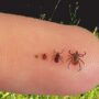 Клещи заразили боррелиозом девятерых жителей Саратовской области
