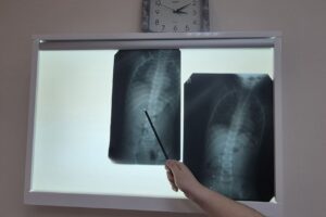 Опасные «сувениры». В больницу Балаково поступили дети с инородными телами в организме
