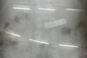  За выходные в больнице Балаково спасли двух детей, проглотивших батарейки