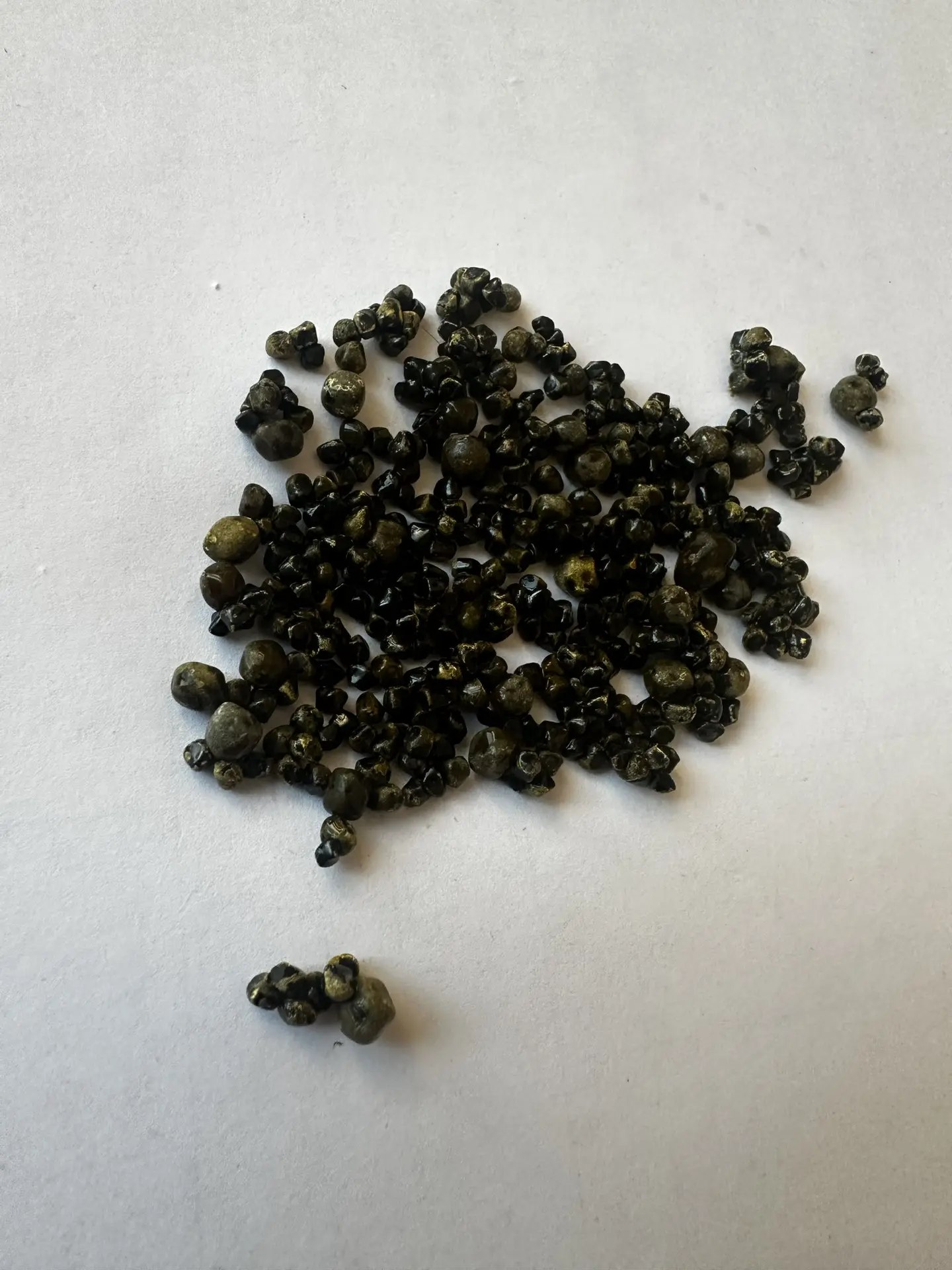 Каменный букет в здоровом теле. 50-летняя пациентка удивила балаковских хирургов