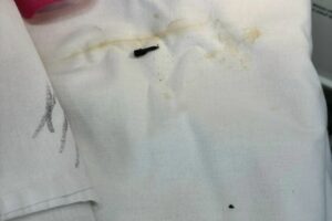 Балаковские хирурги достали семечку из легких годовалого ребенка