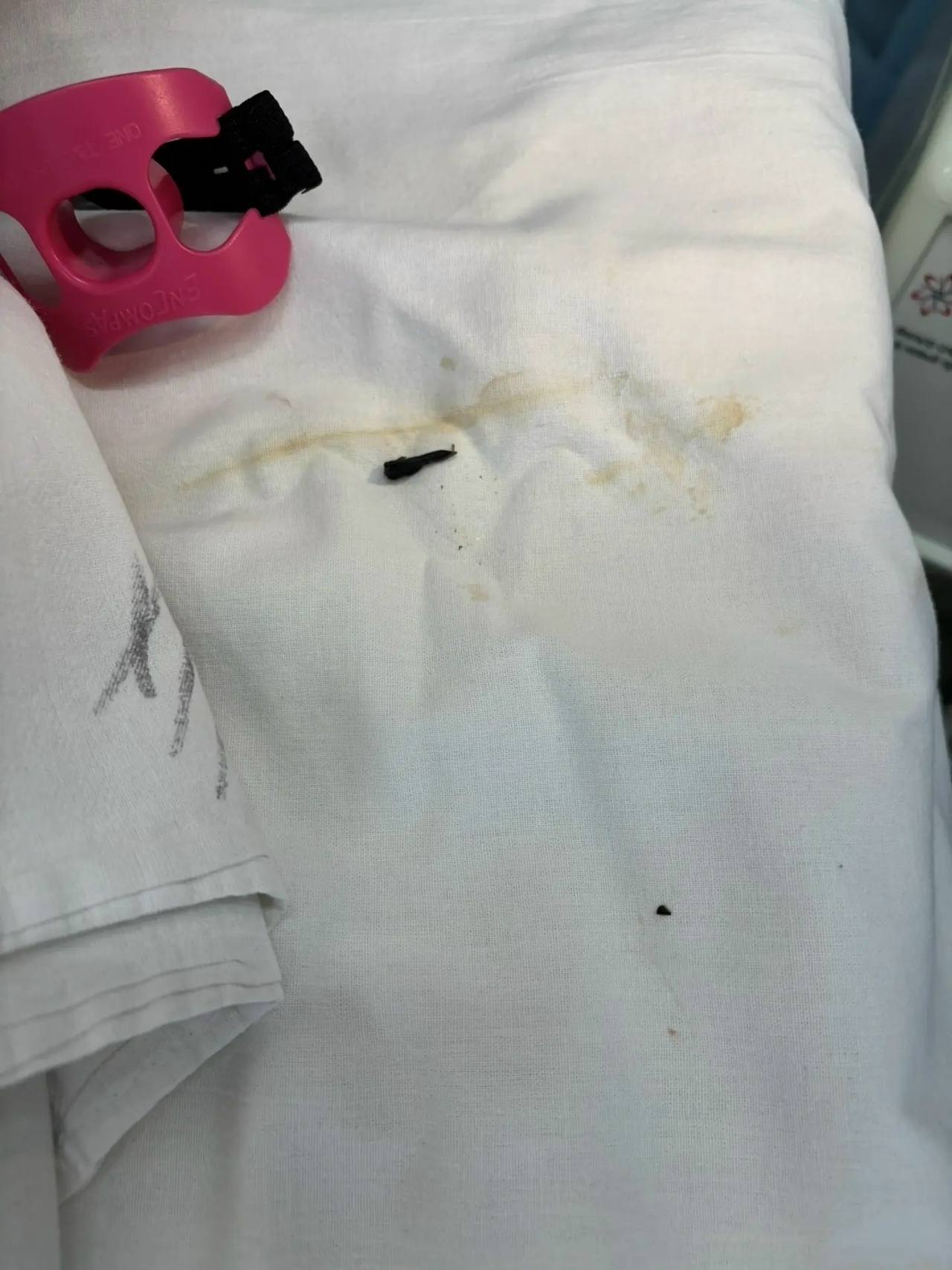 Балаковские хирурги достали семечку из легких годовалого ребенка