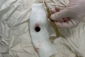 Абрикосовая косточка едва не убила балаковскую пенсионерку